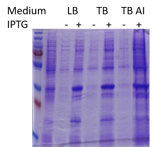 Production in bacteria (erlen)