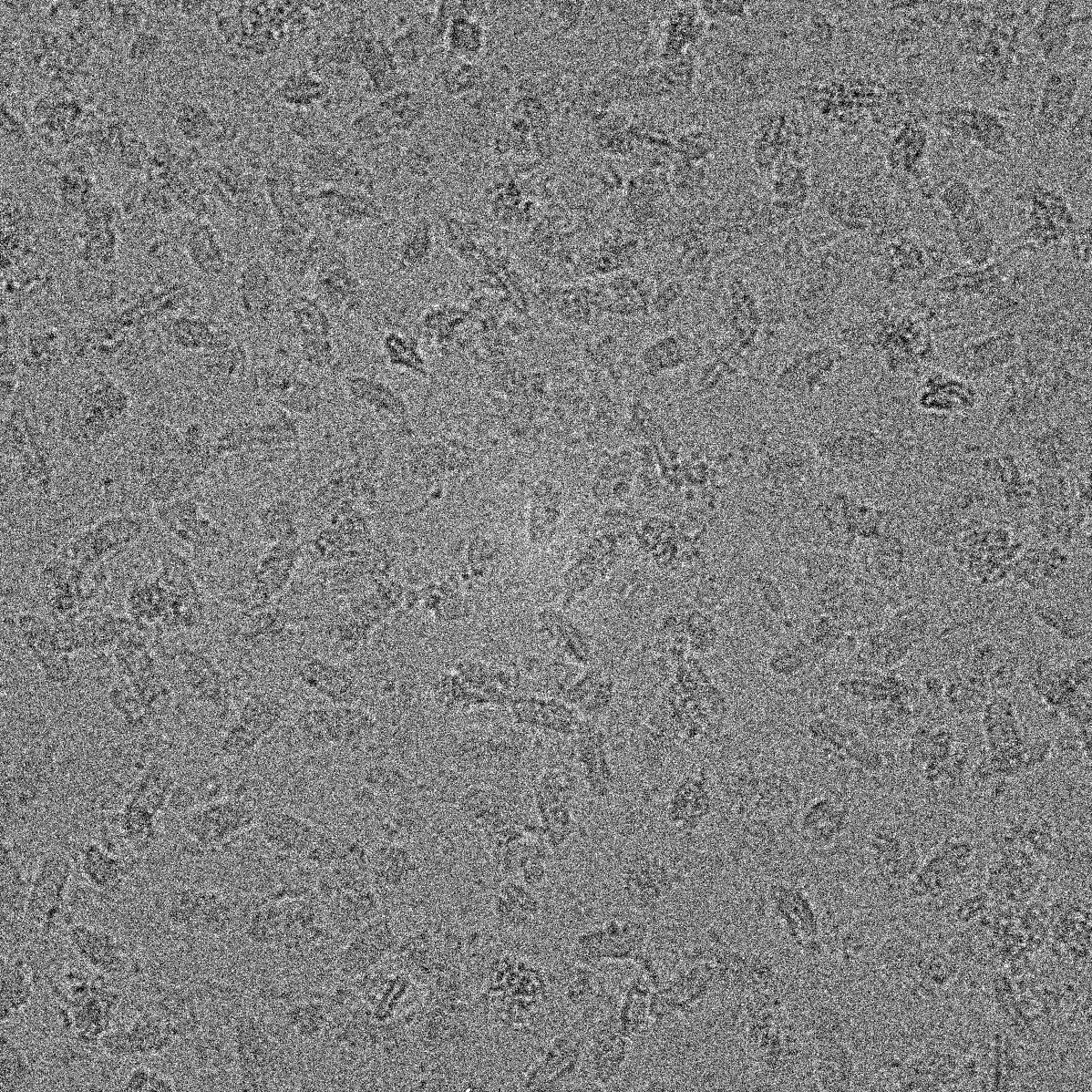 Respi_complex