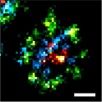 Analysis by super-resolution microscopy